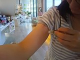 さっそく刺されたところにコロコロ さっそく刺されたところにコロコロ